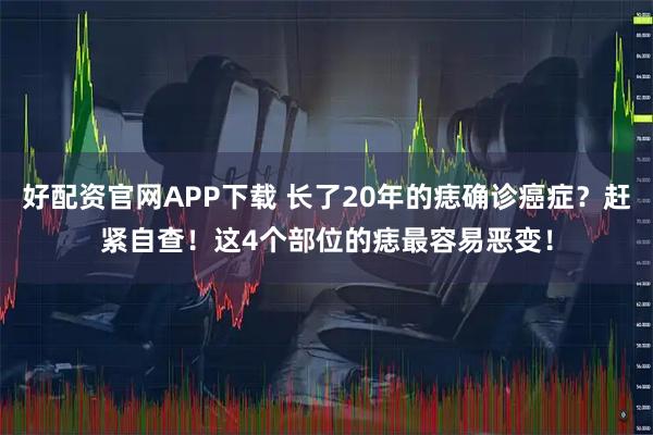 好配资官网APP下载 长了20年的痣确诊癌症？赶紧自查！这4个部位的痣最容易恶变！